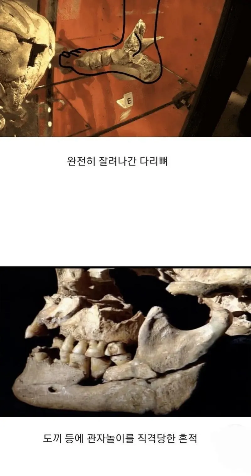 15세기 영국, 병사들의 유골