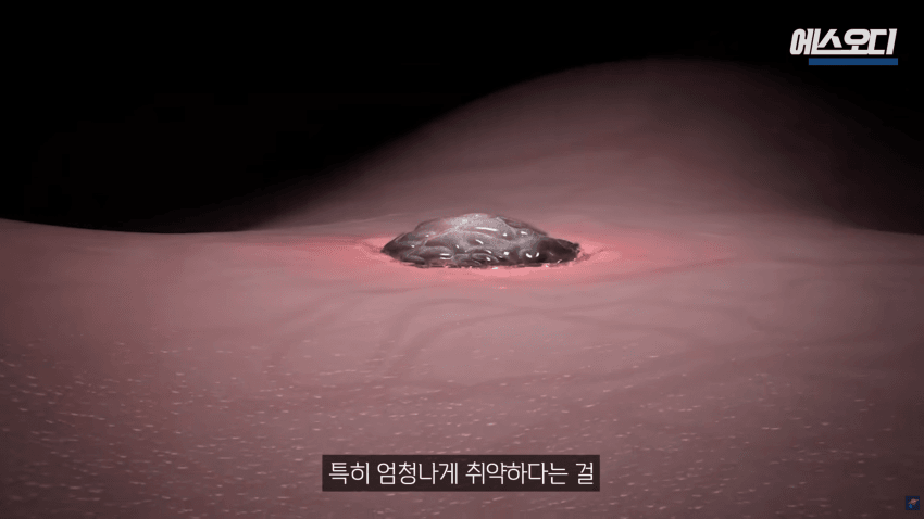 비아그라는 위대했다..역대급 암치료법 등장 (35)
