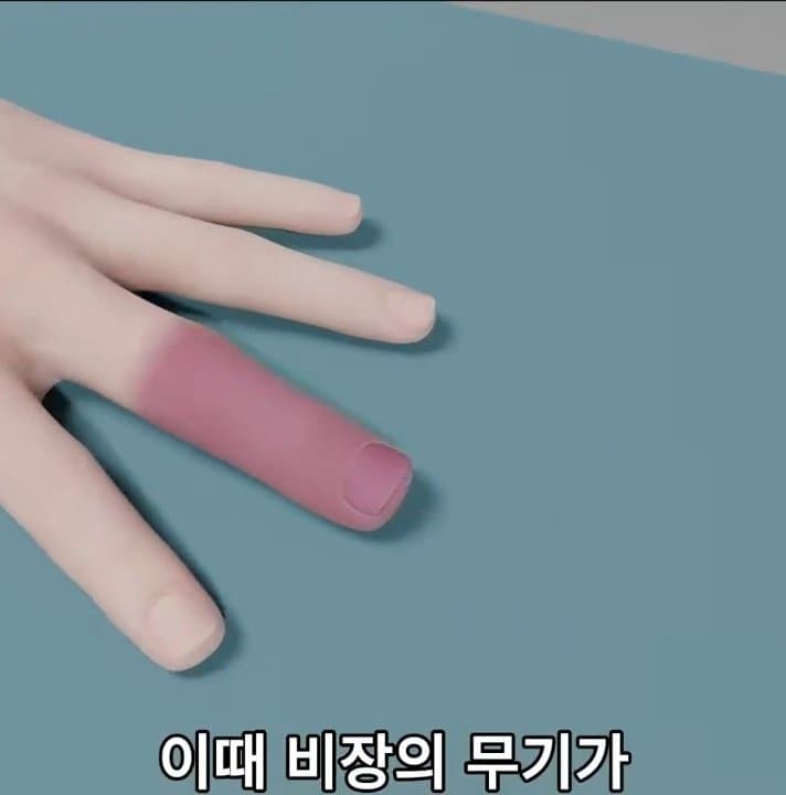 싱글벙글 손가락이 잘렸을 때 대처법 (42)