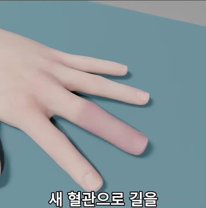 싱글벙글 손가락이 잘렸을 때 대처법 (49)