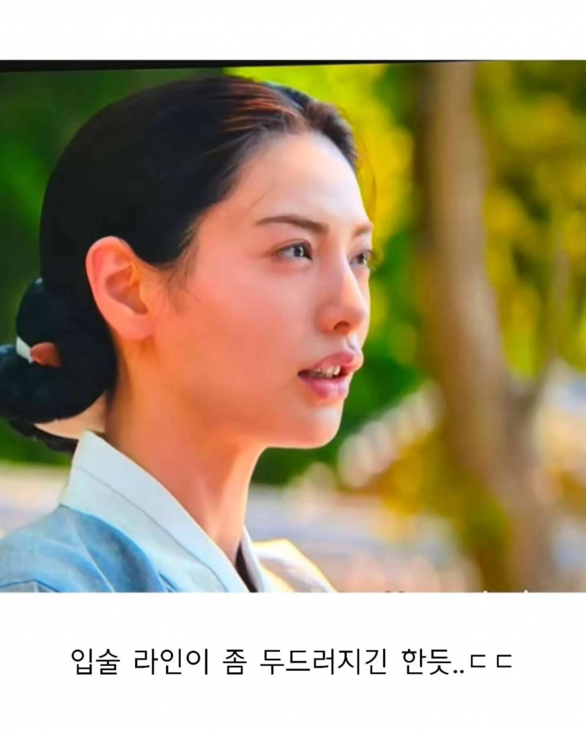 [단독] 스캔들 혹평 나나 “입술 필러 맞은거 잘못..죄송” (5)