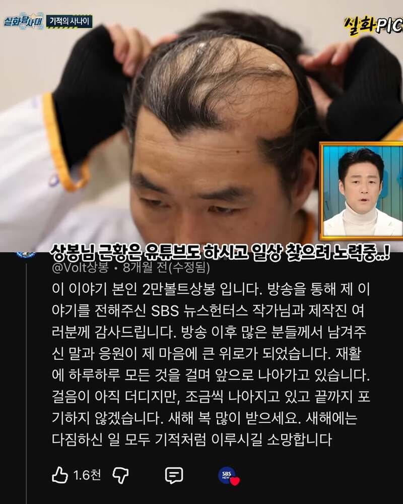 2만볼트 감전되었다 깨어난남성, 깨어난후가 더 지옥 (8)