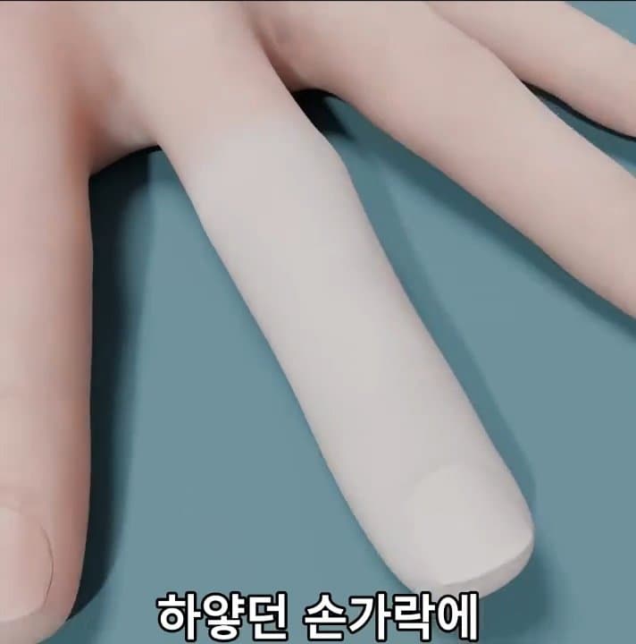 싱글벙글 손가락이 잘렸을 때 대처법 (31)