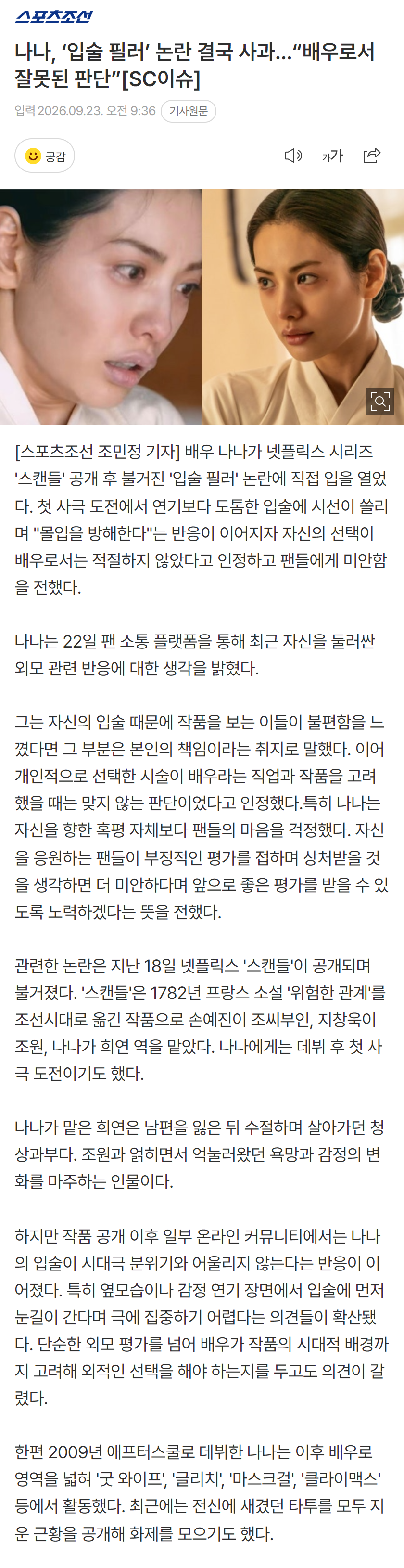 [단독] 스캔들 혹평 나나 “입술 필러 맞은거 잘못..죄송” (4)