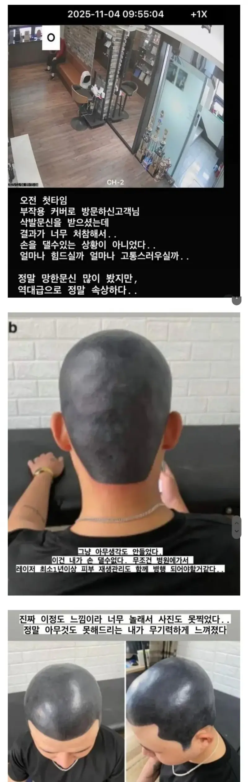 타투샵 사장이 병원 가라고 한 문신.