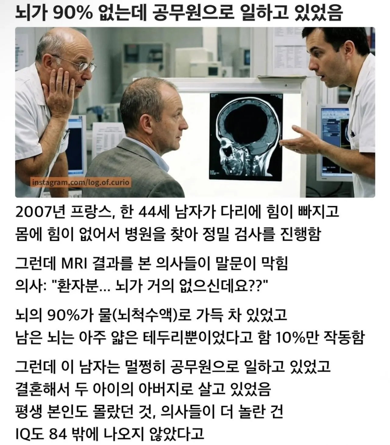 뇌의 90%가 없어졌는데 공무원으로 일하고 있었음