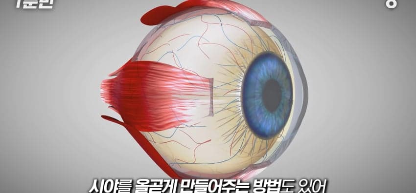 사시는 과연 어떻게 보일까...? (38)