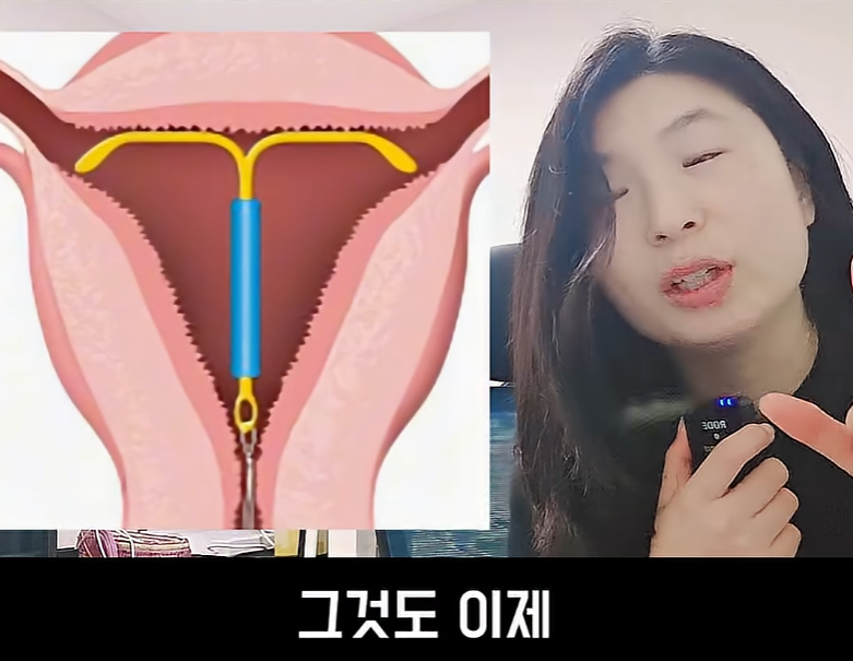 문제가 심각하다는 불임률 (18)