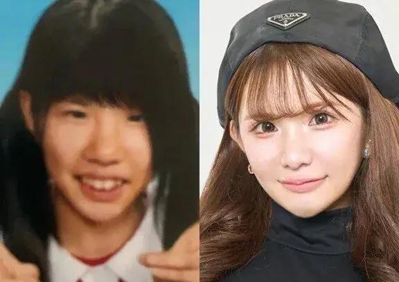 충격적인 2억원어치 성형결과.. (4)