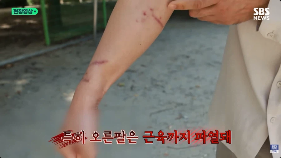 개물림 사고를 낸 견주의 황당한 주장 (4)