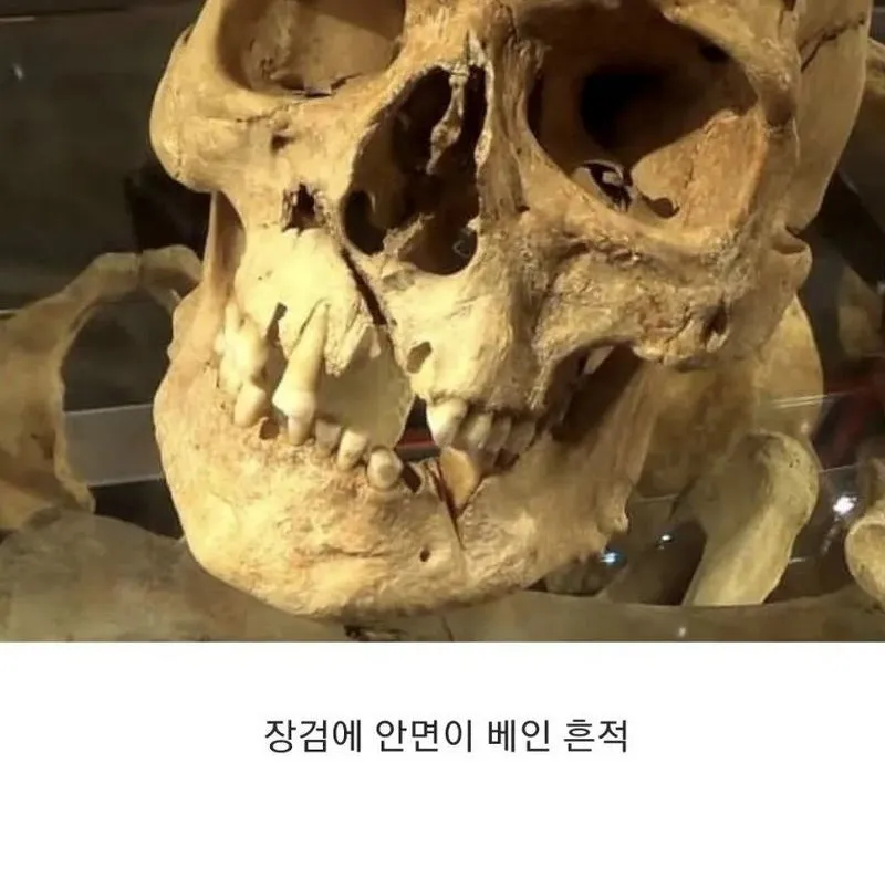 15세기 영국, 병사들의 유골