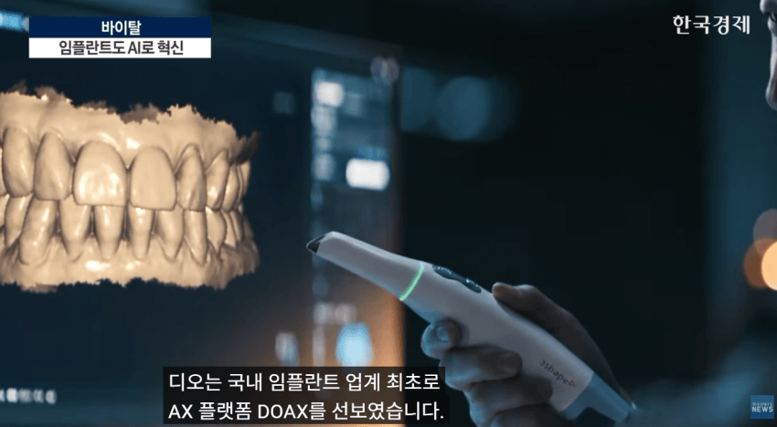 임플란트도 AI가 대세…수술 하루 만에 끝낸다 (11)