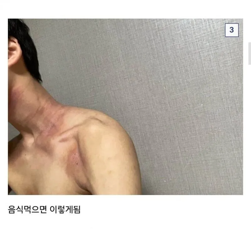 쌀 알레르기 있는데 군대 가는 썰 (4)