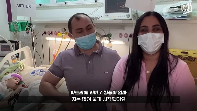33시간 수술 끝에 얼굴 본 쌍둥이 (44)