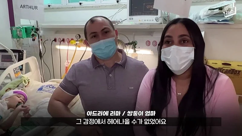 33시간 수술 끝에 얼굴 본 쌍둥이 (45)