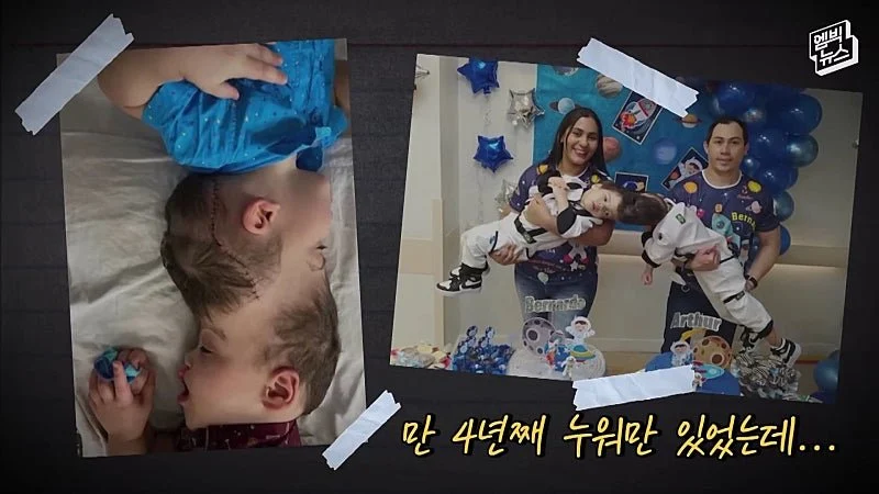 33시간 수술 끝에 얼굴 본 쌍둥이 (7)