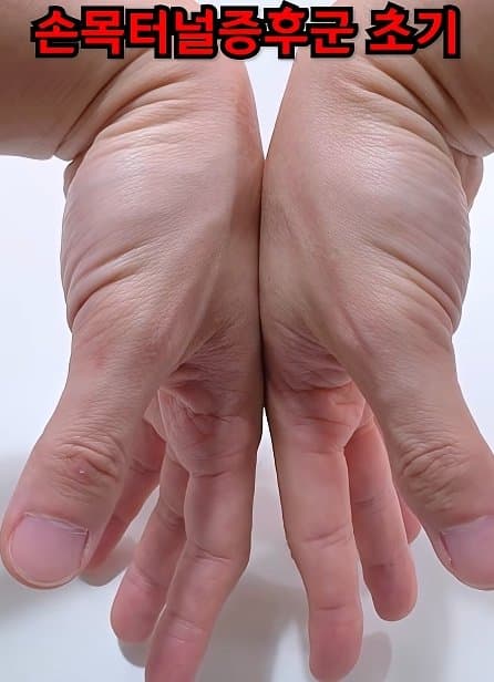 긴급) 지금 이동작 안되면 바로 병원에 가야 합니다! (15)