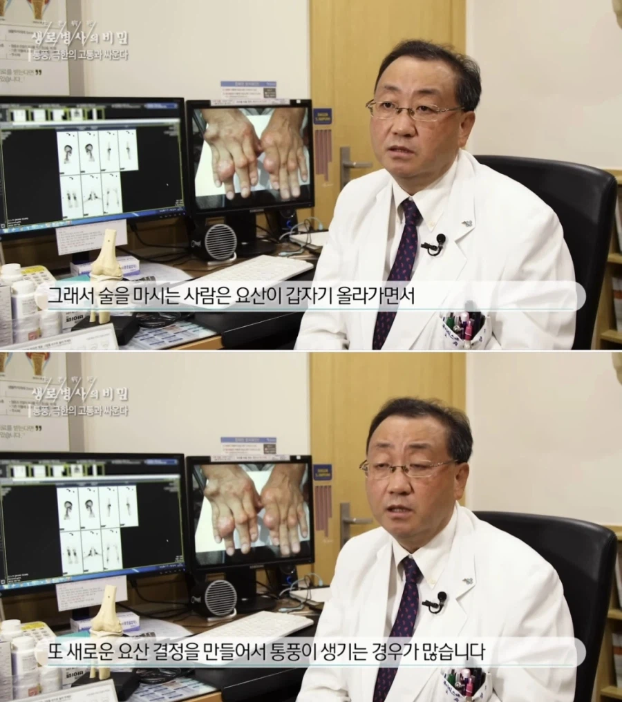 소주엔 퓨린이 없다고? ㅋㅋㅋㅋ통풍 안걸리네 개꿀 (4)