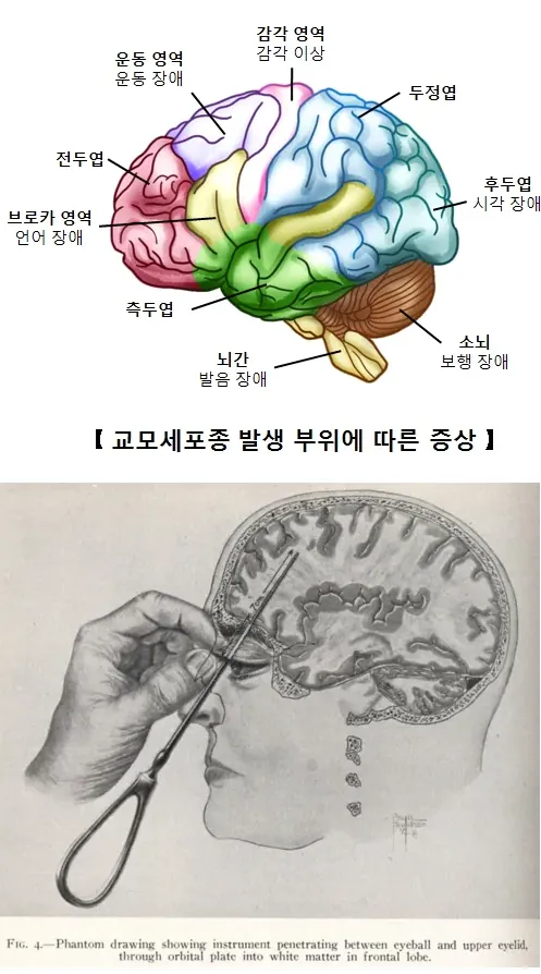 image.png 인류가 알고 있는 유일한 조현병 완치법
