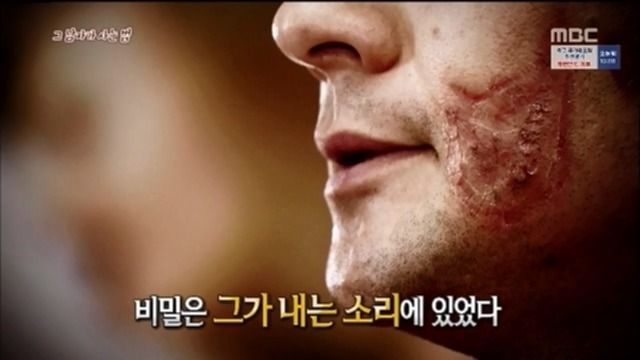싱글벙글 리신이 음파 잘 맞히는 비법 (16)