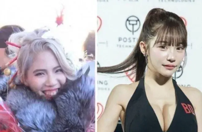 충격적인 2억원어치 성형결과.. (2)