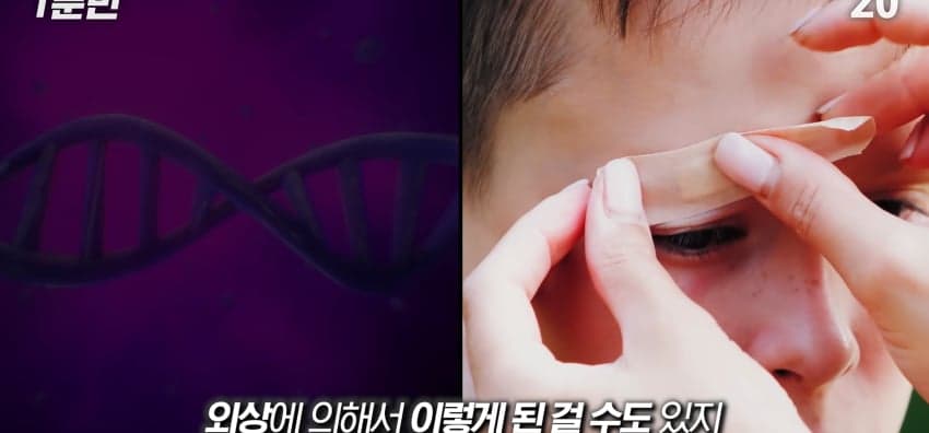 사시는 과연 어떻게 보일까...? (30)