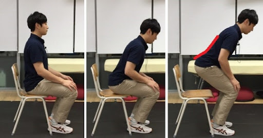 TIP클리닉 :: 상담ㆍ게시판 :: 척추관 협착증