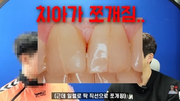 잠수함을 타면 겪는 신체적 변화 (10)