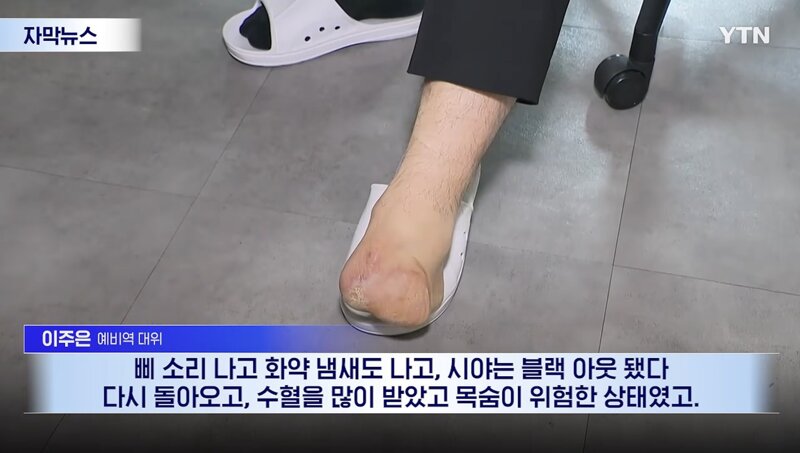 지뢰 밟아 발목 절단된 대위님 (2)