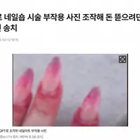 손 다쳤다고 Chat GPT로 조작한 튀르키예 난민