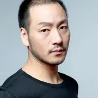 모발이식 이후 잘 풀리는 중이라는 배우