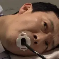 사람마다 갈린다는 비수면 위내시경 후기