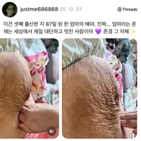 (펌글) 스레드에 올라온 애기 셋 낳은 어머니 배 사진 논란