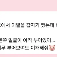 팬들 사이에서 속상하다고 말나오는 트와이스 스케줄 (모모 생니 뺌...ㅜㅜ)