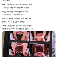 원래 치과가면 치아 상태 사진 이러고 찍어...?