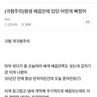 (극혐주의) 평생 배꼽안에 있던 어떤게 빠졌어