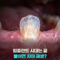 또 사고친 국내 연구진 소식